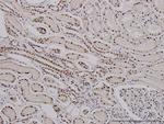 SF3B2 Antibody in Immunohistochemistry (Paraffin) (IHC (P))