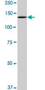 SF3B2 Antibody in Western Blot (WB)