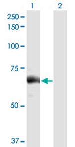 SLC27A5 Polyclonal Antibody, MaxPab™