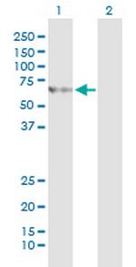 SLC27A5 Antibody in Western Blot (WB)