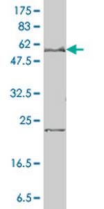 SLC27A4 Monoclonal Antibody (1F4-1B10)