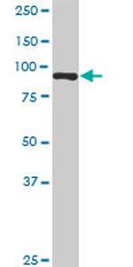 KIF2C Antibody in Western Blot (WB)
