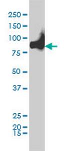 KIF2C Antibody in Western Blot (WB)