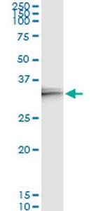IL24 Monoclonal Antibody (4B6)