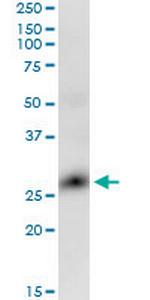 GLIPR1 Antibody in Western Blot (WB)