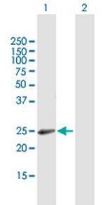 RAB31 Antibody in Western Blot (WB)