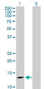 SMA4 Antibody in Western Blot (WB)