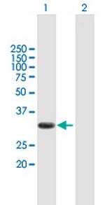 PIM2 Antibody in Western Blot (WB)