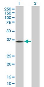 PIM2 Antibody in Western Blot (WB)