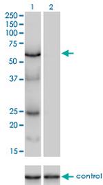 POLS Monoclonal Antibody (2F8)