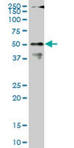 CPSF6 Monoclonal Antibody (1C5)