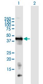 LECT1 Polyclonal Antibody, MaxPab™