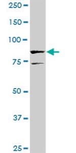 SOX30 Antibody in Western Blot (WB)