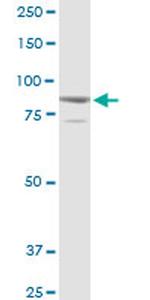SOX30 Antibody in Western Blot (WB)