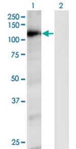 RAPGEF4 Monoclonal Antibody (1C11)