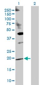 DUSP14 Polyclonal Antibody, MaxPab™