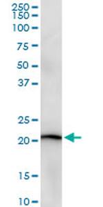 STMN2 Monoclonal Antibody (2E3)