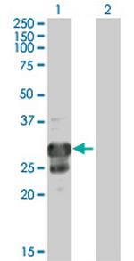 TPPP Polyclonal Antibody, MaxPab™