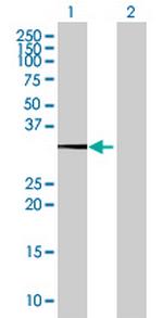 HSF2BP Polyclonal Antibody, MaxPab™