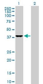 DNAJB4 Antibody in Western Blot (WB)