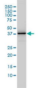 DNAJB4 Antibody in Western Blot (WB)