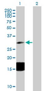 ESM1 Polyclonal Antibody, MaxPab™