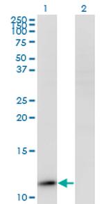 RPP14 Antibody in Western Blot (WB)