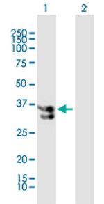KATNA1 Polyclonal Antibody, MaxPab™