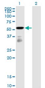 FGFR1OP Antibody in Western Blot (WB)