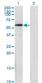 FGFR1OP Antibody in Western Blot (WB)