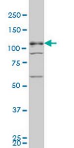 TBC1D8 Monoclonal Antibody (1A12)