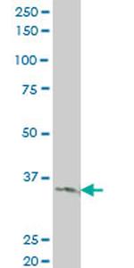 LDB3 Antibody in Western Blot (WB)