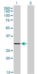 LDB3 Antibody in Western Blot (WB)