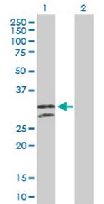 NUDT6 Antibody in Western Blot (WB)