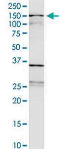 WDHD1 Monoclonal Antibody (2F10)