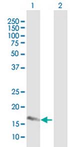 FAM107A Antibody in Western Blot (WB)
