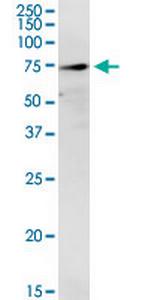 TREH Monoclonal Antibody (2D10)