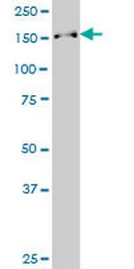 SUPT16H Antibody in Western Blot (WB)