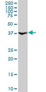 ANXA10 Antibody in Western Blot (WB)