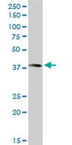 ANXA10 Antibody in Western Blot (WB)