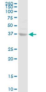ANXA10 Antibody in Western Blot (WB)