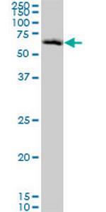 CHEK2 Antibody in Western Blot (WB)