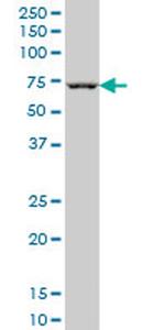 CHEK2 Antibody in Western Blot (WB)