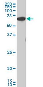 CHEK2 Antibody in Western Blot (WB)