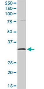 KLK8 Antibody in Western Blot (WB)