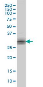 KLK8 Monoclonal Antibody (2F11)