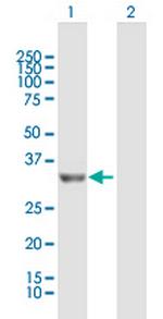PROSC Polyclonal Antibody, MaxPab™