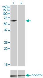 IRAK3 Monoclonal Antibody (1F6)