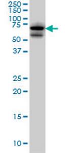 AKAP10 Antibody in Western Blot (WB)