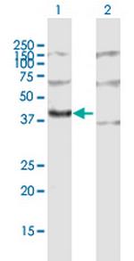 MRPL3 Polyclonal Antibody, MaxPab™